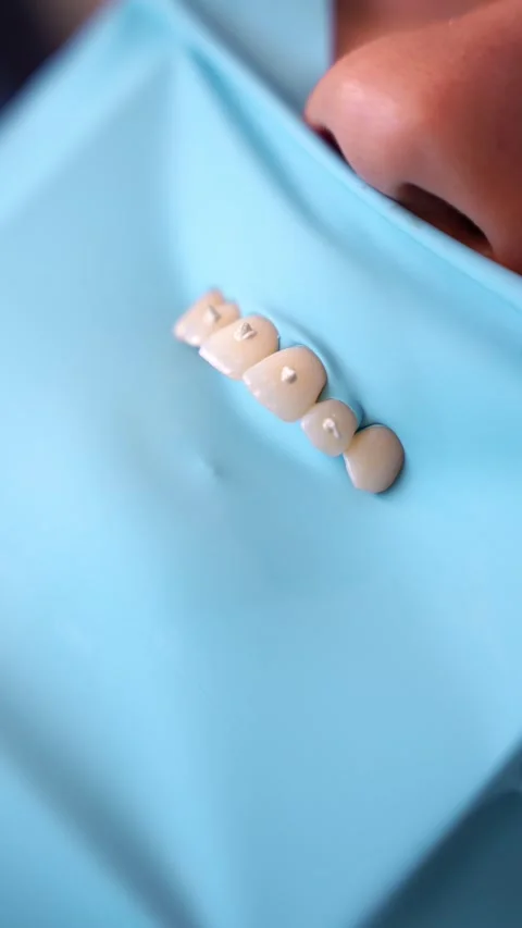 Dental Prototyping in Laboratory Stock Footage 331163481