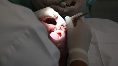 Dental restoration Stock Footage 46530764