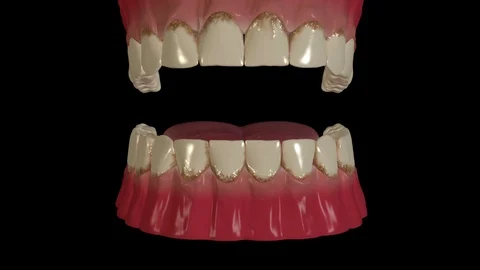 Dental Scaling Procedure 스톡 동영상 126940474