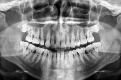 Dental scan Stock Photos