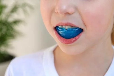 Dental simulator for teeth alignment . The child has mouth guards on his teet Stock Photos