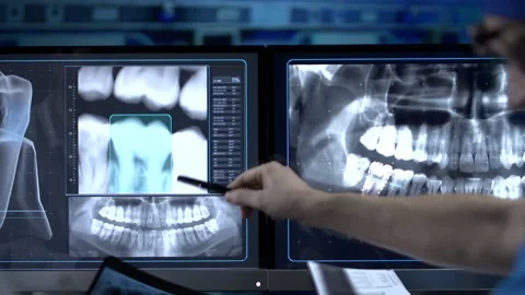 Dental surgery analysis x-ray Stock Footage 200161697