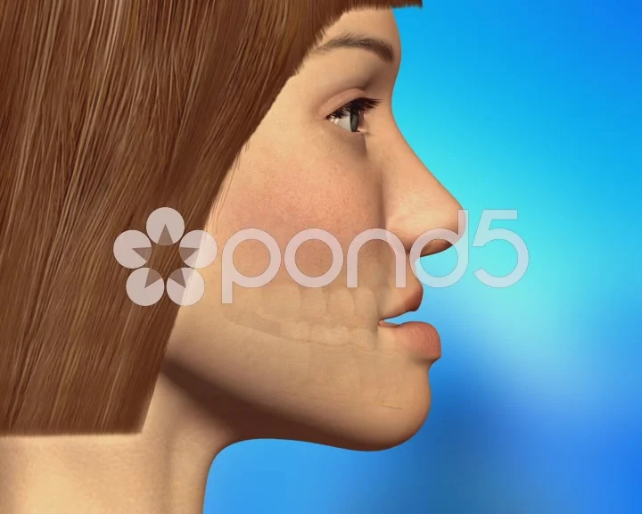 Dental Surgery Animation of Teeth, Brace... | Stock Video | Pond5