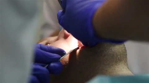 Dental surgery Stock Footage