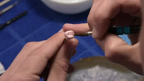 Dental technician applies ceramic material to the crown of a dental implant 動画素材 169936346