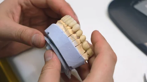 Dental technician is making teeth implats. Close view of his hands Vidéo 102958310