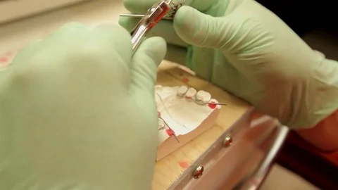 A dental technician models a device for the teeth. About the oral hygiene Stock Footage 71582536