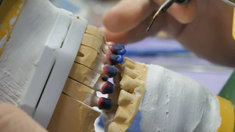 Dental technician processing dentures Stock Footage 99897843