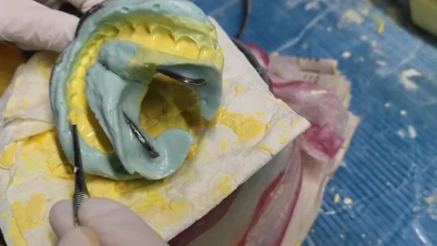 Dental technician using tools to clear bubble in dental plaster Stock Footage 148426312