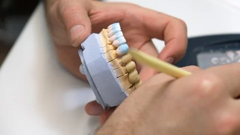 Dental technician work. prosthesis production. teeth prototype construction Vidéo 102957662