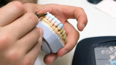 Dental technician work. prosthesis production. teeth prototype construction Vidéo 102957697