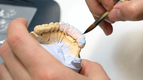 Dental technician work. prosthesis production. teeth prototype construction Vidéo 102957732