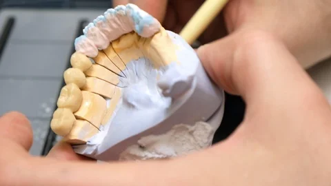 Dental technician work. prosthesis production. teeth prototype construction Vidéo 102957745