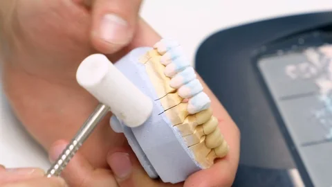 Dental technician work. prosthesis production. teeth prototype construction Vidéo 102958384