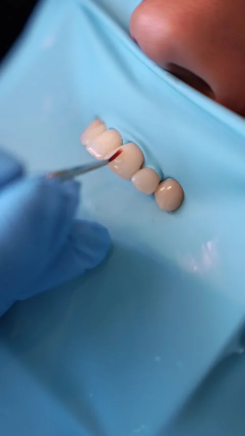 Dental Technician Working on Prosthetic Teeth Stock Footage 331163620