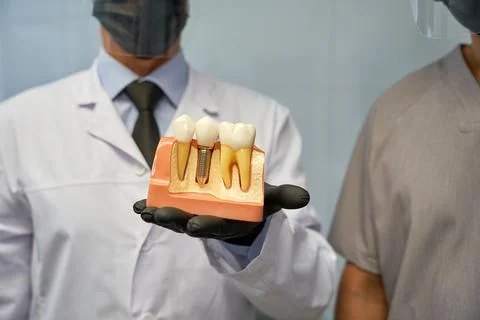 Dental technicians presenting a model of artificial tooth implant Foto stock