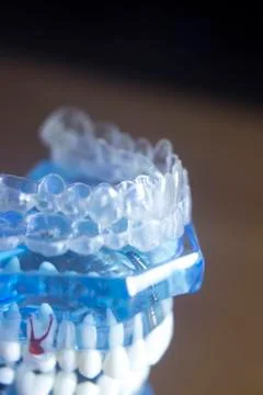 Dental teeth bracets model Stock Photos