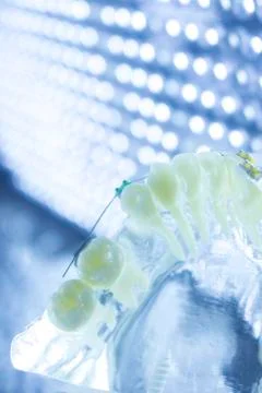 Dental teeth brackets aligners Stock Photos