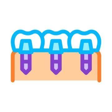 Dental Teeth Implants Biomaterial Vector Icon Illustrazione stock