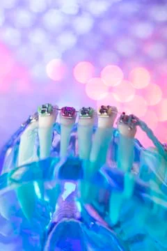 Dental teeth metal brackets Stock Photos