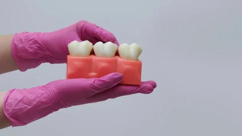 Dental Teeth Model Held by Technician in Gloves Stock Footage 333550582