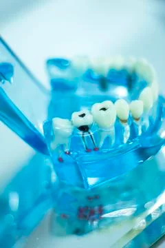 Dental teeth student model Stock Photos