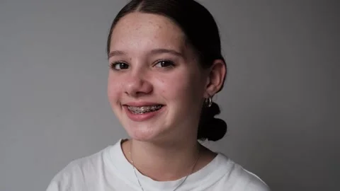 Dental treatment with a bracket system 스톡 동영상 307441602