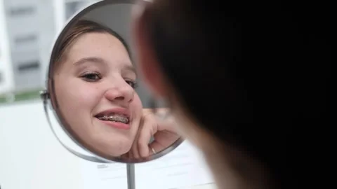 Dental treatment with a bracket system Stock Footage 307441756