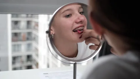Dental treatment with a bracket system Stock Footage 307441848