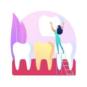 Dental veneers abstract concept vector illustration. Stock Illustration