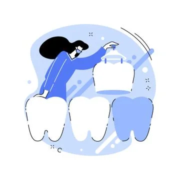 Dental veneers abstract concept vector illustration. Stock Illustration