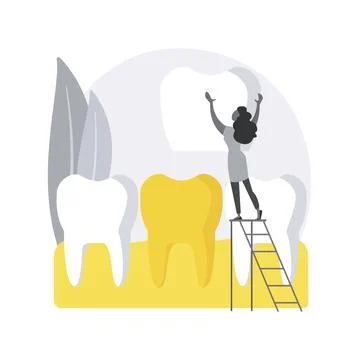 Dental veneers abstract concept vector illustration. Stock Illustration