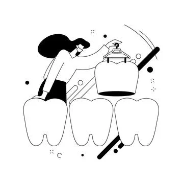 Dental veneers abstract concept vector illustration. Stock Illustration