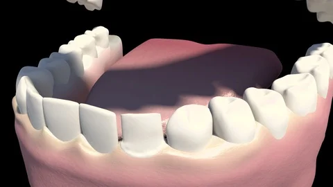 Dental Veneers Video stock 121536543