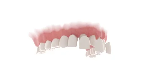 Dental veneers Stock Footage 196180819