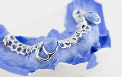 Dental wire bending for make a partial denture Stock-Fotos