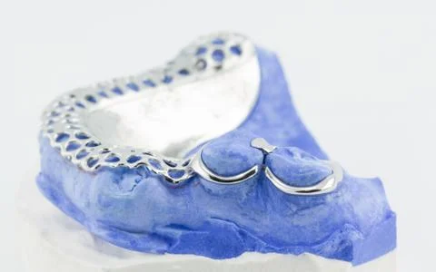 Dental wire bending for make a partial denture 库存照片