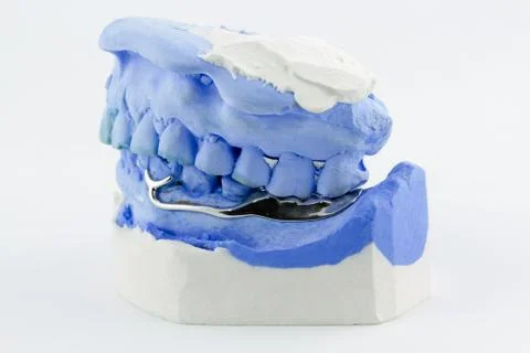 Dental wire bending for make a partial denture Stock Photos