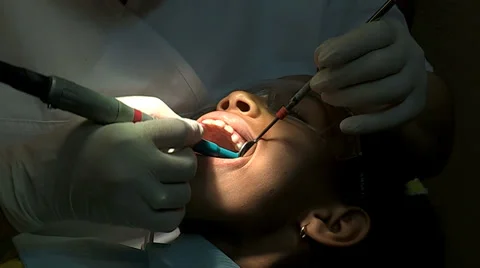 Dental Work Close Up Stock Footage 33827971