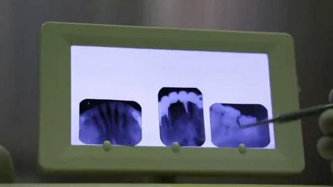 Dental X-ray analysis Video stock 69220019