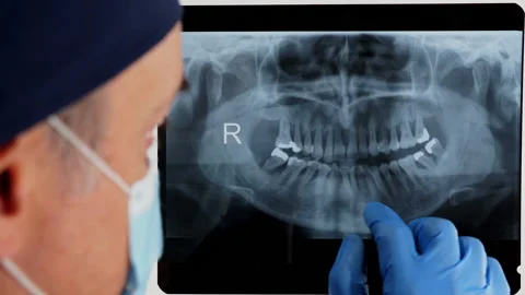 Dental X-ray  Stock Footage 159419430