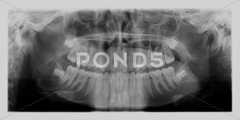 Dental x-ray Stock Photos