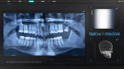 Dental X-Ray Scan Interface on Digital Monitor Screen Stock Footage 347682900