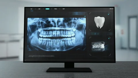 Dental X-Ray Software Displayed on Computer Monitor in Clinic Stock Footage 347682895
