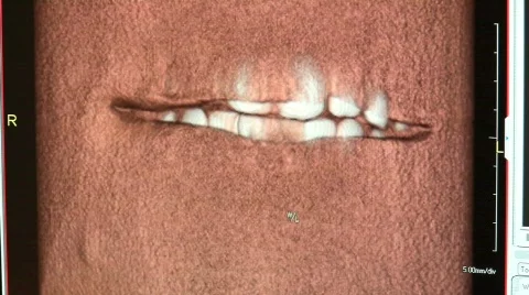 Dental X-rays 1 Stock Footage 646155