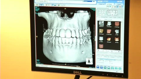Dental X-rays 2 Stock Footage 646152