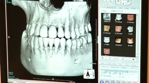 Dental X-rays 3 Stock Footage 646150