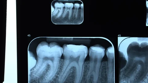 Dental X-rays of various sizes at dentist office Vídeos de archivo 88222760