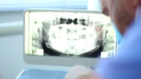 Dental Xray Video stock 84722782