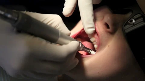 Dental2 Stock Footage 1099001